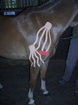 lymph1